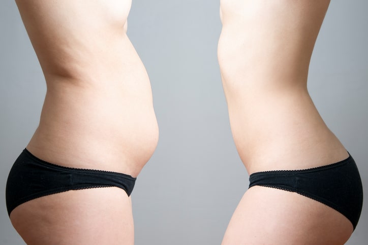 Discover The Best Liposuction Clinics For Slimmer Results